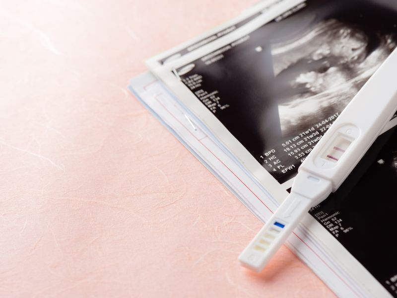 Hoge bloeddruk zwangerschap